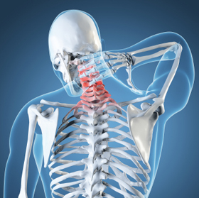 Manufacturers Exporters and Wholesale Suppliers of Cervical Pain New Delhi Delhi